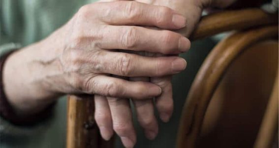 Rheumatoid Arthritis