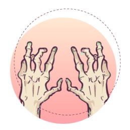 Symmetrical arthritis