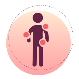 Rheumatoid nodules