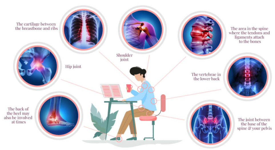 Ankle joint, Hip Joint, Ribcage, Shoulder joint, Spine tendons and ligaments, Lower back vertebrae, Sacroiliac joint